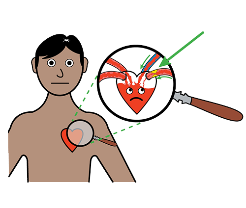 heart disease symbol